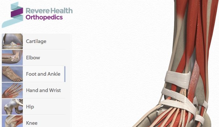 Orthopedic Interactive Animation